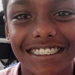 16-year-old girl undergoes robot-assisted heart surgery at Tamil Nadu Government Multi Super Speciality Hospital