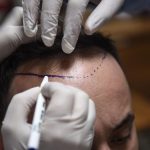 T.N. doctors flag staffing, infrastructure gaps at new government hospitals