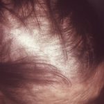 Tamil Nadu is grappling with a severe shortage of village health nurses Premium