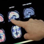 How a homeopathic medicine landed a KSRTC driver from Kozhikode in trouble