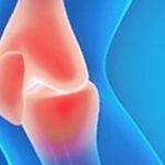 All you need to know about: Premenstrual Dysphoric Disorder Premium