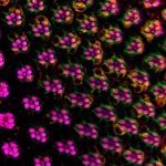 All you need to know about: measles Premium