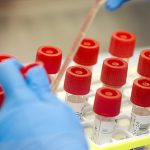 CMC doctors’ dream to make quality healthcare affordable takes wing in Hyderabad Premium