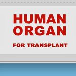 TAVI, a minimally invasive procedure for treating severe heart valve diseases in high-risk patients Premium