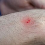 SIMS Hospitals launches a one-stop women’s wellness care centre