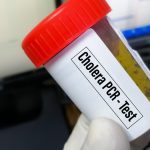 Persistent hoarseness or sore throat over two weeks could indicate serious vocal cord issues and require medical attention Premium