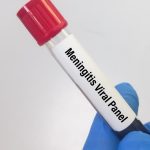 Snake-bitten patients get a new lease of life at Kozhikode MCH