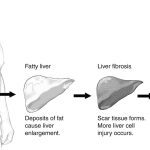 The science behind ‘miracle babies’ born of uterine transplants Premium
