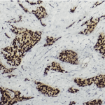 Manipal Foundation donates 23 portable battery powered refrigeration devices to Health Department of Karnataka