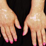 ZEISS India to drive Karnataka’s eye-care campaign Vidya Drishti