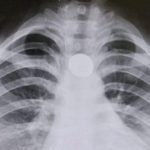 Ranji Trophy Semifinals HIGHLIGHTS, Day 1: VID 304/5 vs MUM at stumps; Azharudden survives late scare as KER reaches 206/4 vs GUJ